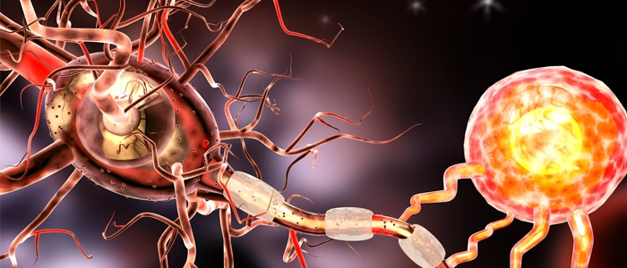 Reprodução 3D de como a esclerose múltipla age nas células cerebrais